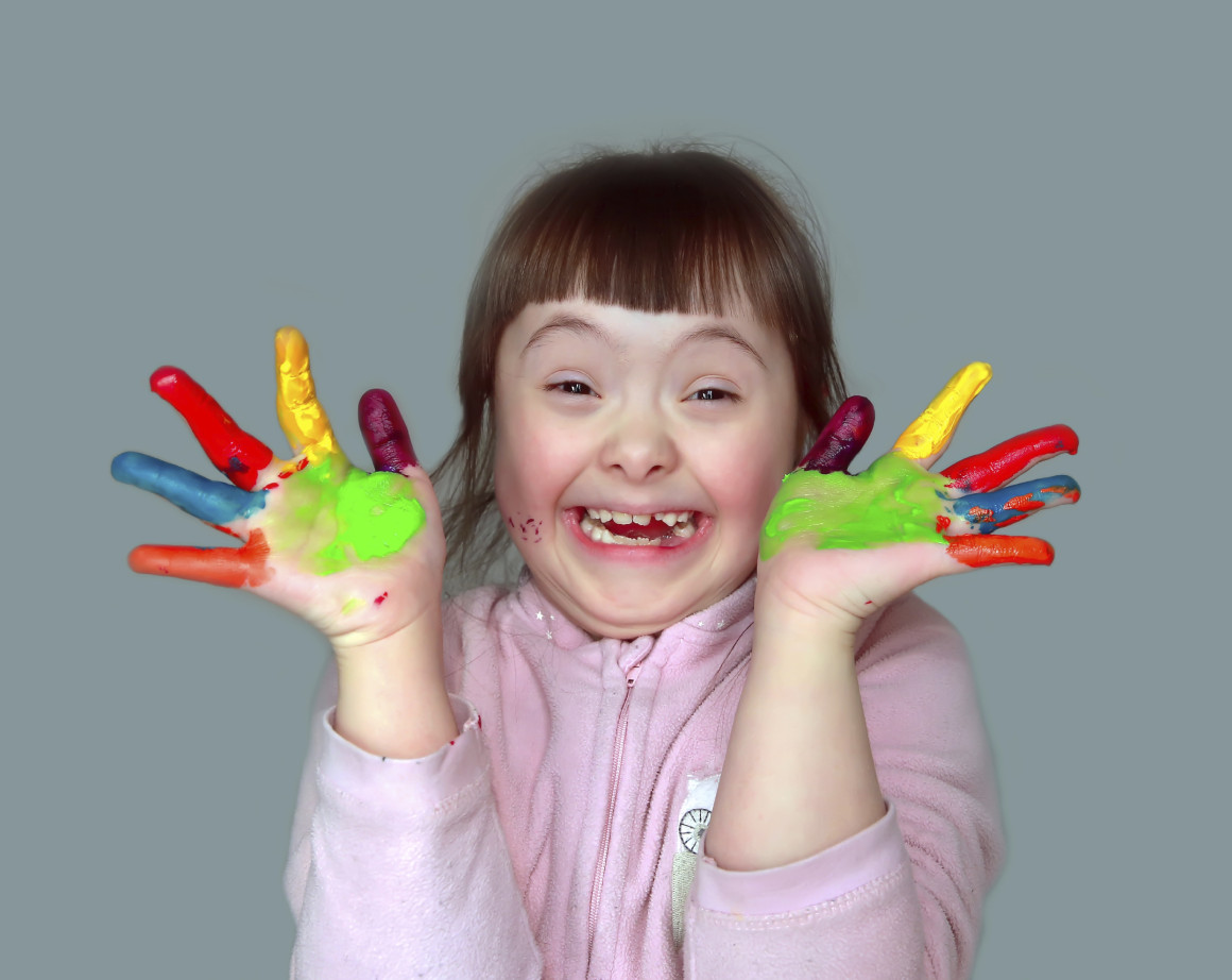 Soñar con una niña con síndrome de down